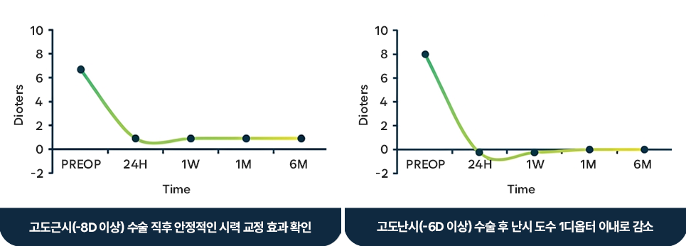 고도근시 수술 후 경과 관찰