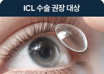 ICL 수술 권장 대상