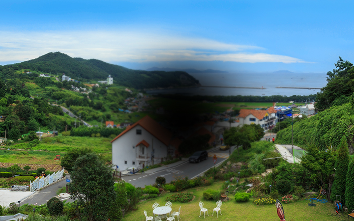 바른안과 황반변성