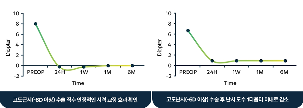 고도근시 수술 후 경과 관찰